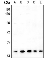 Anti-ARRDC4 Antibody