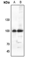 Anti-ATP1A1 Antibody
