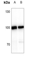 ATP6V0A2 antibody