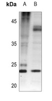 Anti-BAD (Phospho-S112) Antibody