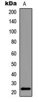 Anti-BAD (Phospho-S155) Antibody