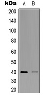 Anti-ZNF134 Antibody