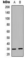 Anti-BCLX (Phospho-S62) Antibody