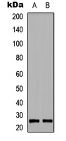 Anti-BIM (Phospho-S69) Antibody