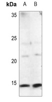 Alpha-type CGRP antibody