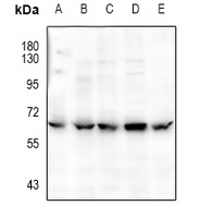 CaMK2 alpha/delta (phospho-T286) antibody