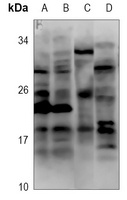 CCL11 antibody