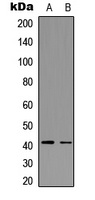 Anti-CCR5 (Phospho-S336) Antibody