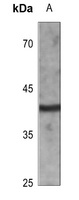 CD72 antibody