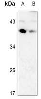 CD79b antibody