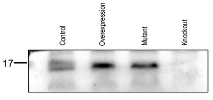 Anti-CDK2AP1 Antibody