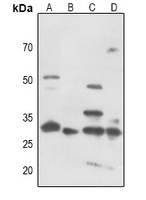 Anti-CDK5 (Phospho-Y15) Antibody