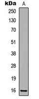 Anti-p16 INK4a (Phospho-S326) Antibody