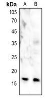 Anti-CENPA Antibody