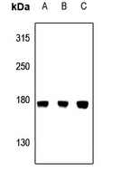 CEP170 antibody