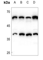 Anti-CERKL Antibody