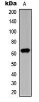 Anti-CHK2 (Phospho-T387) Antibody