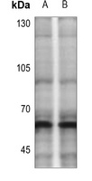 CHK2 (phospho-T383) antibody