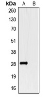 GST-tag antibody