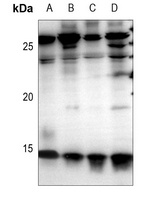 Cystatin C antibody