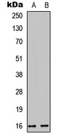 Cystatin E/M antibody