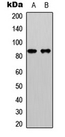 Anti-Beta-catenin (Phospho-S33) Antibody