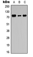 Anti-DDX3Y Antibody
