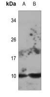 DYNLL2 antibody