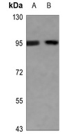 Anti-EEF2 (Phospho-T56) Antibody