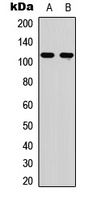 EPHA6 antibody