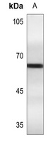ESR1 (phospho-S106) antibody
