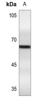 Anti-Estrogen Receptor alpha (Phospho-S106) Antibody