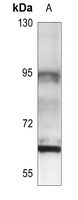 Estrogen Recepter beta 2 antibody