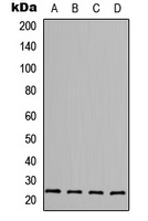 Anti-FGF6 Antibody