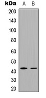 Anti-FOSL1 Antibody