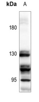 Anti-GABBR1 Antibody