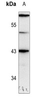 GATA1 (phospho-S310) antibody