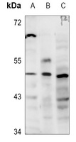 Anti-GATA3 Antibody