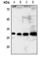 GCLM antibody