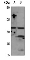 GIT2 antibody