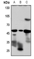 GLP-1 R antibody
