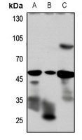 Anti-GLP-1 Receptor Antibody