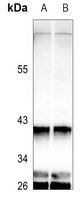 Anti-GNAT1 Antibody