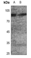 Anti-GLUR2 (Phospho-S880) Antibody
