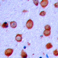 GLUR2 (Phospho-S880) Rabbit Polyclonal Antibody