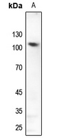 Anti-GLURD2 Antibody