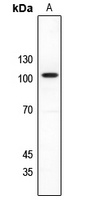 NMDAR1 antibody