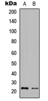 Anti-Granzyme H Antibody
