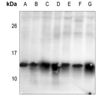 Histone H2B (AcK15) antibody