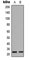 HAND1 antibody